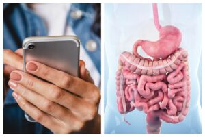 Six-Year Mystery: Mobile Phone Removed from Patient’s Stomach in Egypt